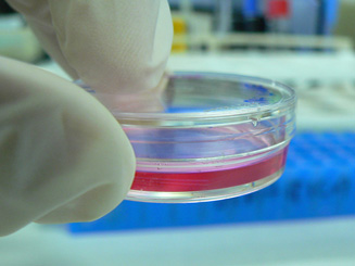 Tissue regeneration